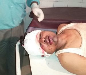 lover-beaten-by-villegrs_badal paswan iin katihar distic siwana village bihar